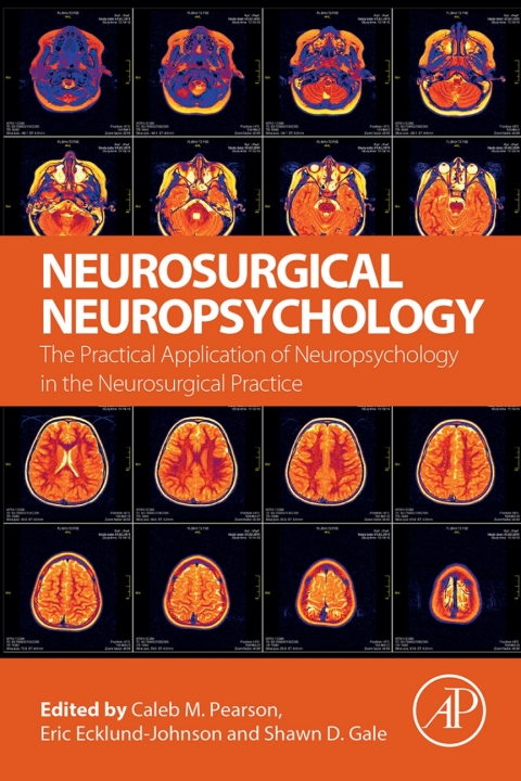 Cover image for book Neurosurgical Neuropsychology