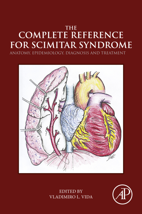 Cover image for book The Complete Reference for Scimitar Syndrome