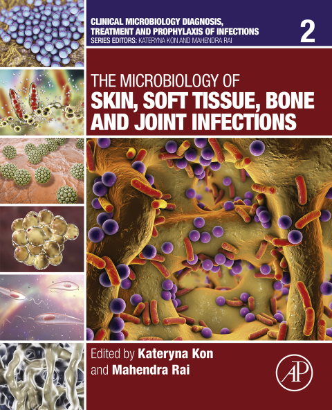Cover image for book The Microbiology of Skin, Soft Tissue, Bone and Joint Infections