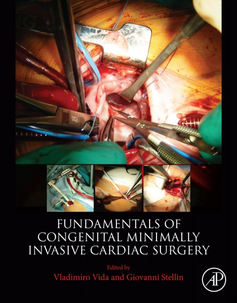 Cover image for book Fundamentals of Congenital Minimally Invasive Cardiac Surgery