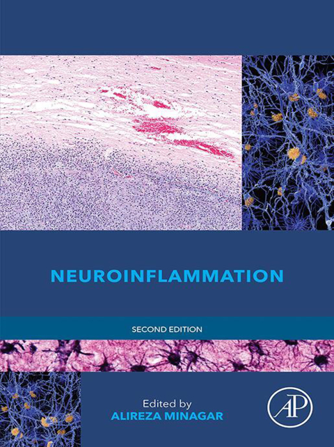 Cover image for book Neuroinflammation