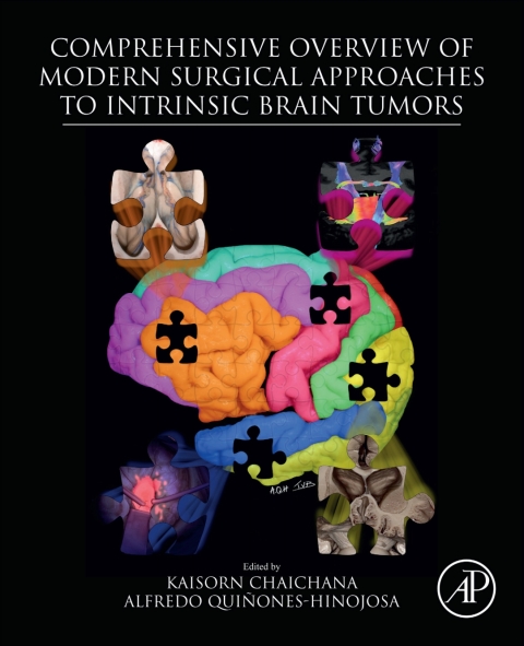 Cover image for book Comprehensive Overview of Modern Surgical Approaches to Intrinsic Brain Tumors