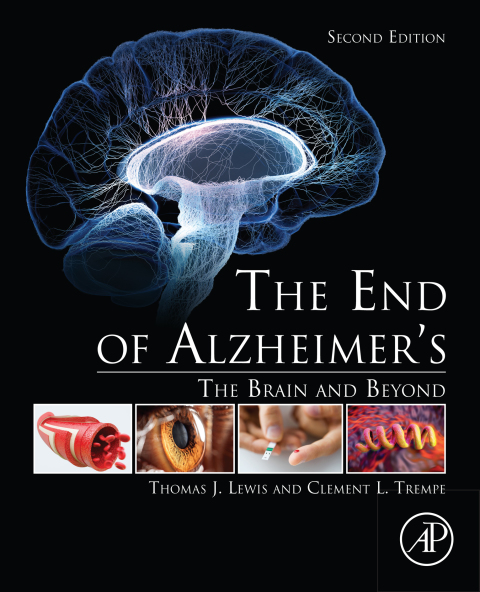 Cover image for book The End of Alzheimer’s
