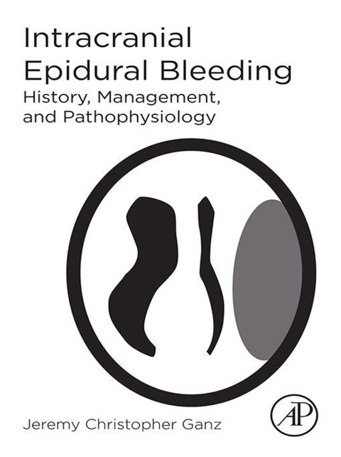 Cover image for book Intracranial Epidural Bleeding