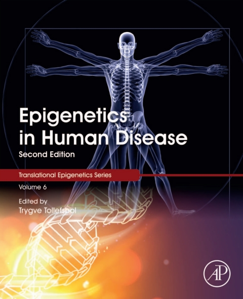 Cover image for book Epigenetics in Human Disease