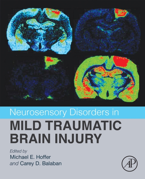 Cover image for book Neurosensory Disorders in Mild Traumatic Brain Injury