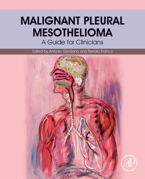 Cover image for book Malignant Pleural Mesothelioma