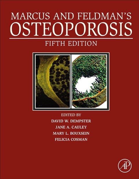 Cover image for book Marcus and Feldman's Osteoporosis