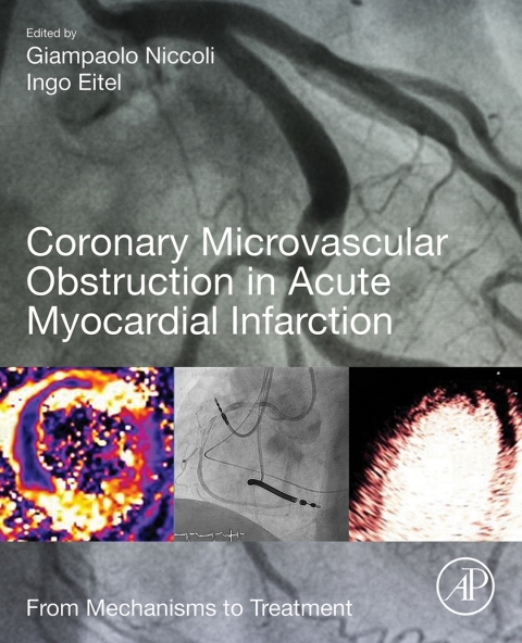 Cover image for book Coronary Microvascular Obstruction in Acute Myocardial Infarction