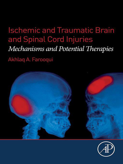 Cover image for book Ischemic and Traumatic Brain and Spinal Cord Injuries