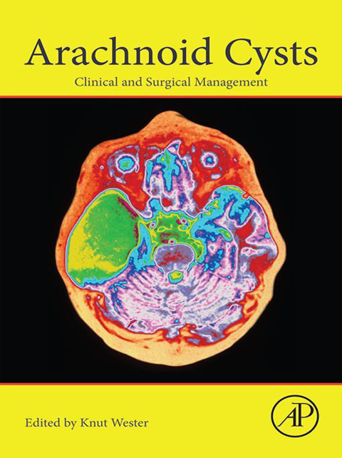 Cover image for book Arachnoid Cysts