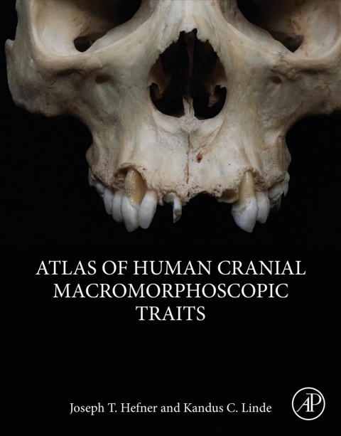 Cover image for book Atlas of Human Cranial Macromorphoscopic Traits