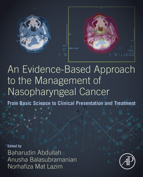 Cover image for book An Evidence-Based Approach to the Management of Nasopharyngeal Cancer