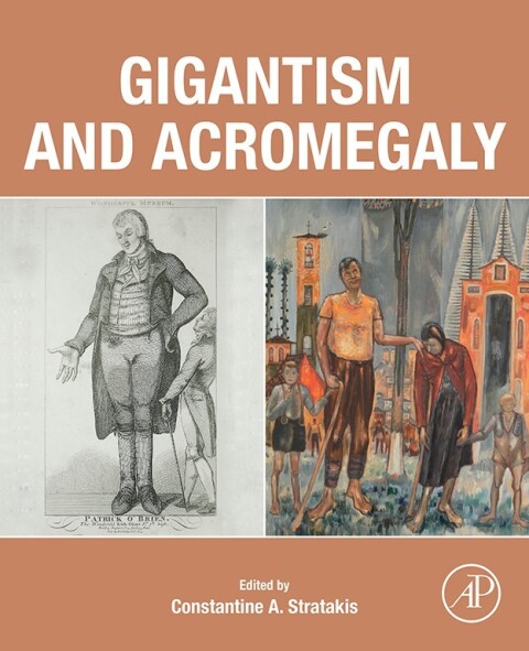 Cover image for book Gigantism and Acromegaly