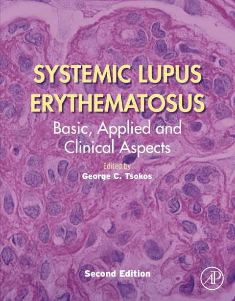Cover image for book Systemic Lupus Erythematosus