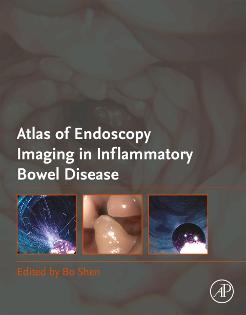 Atlas of Endoscopy Imaging in Inflammatory Bowel Disease 
