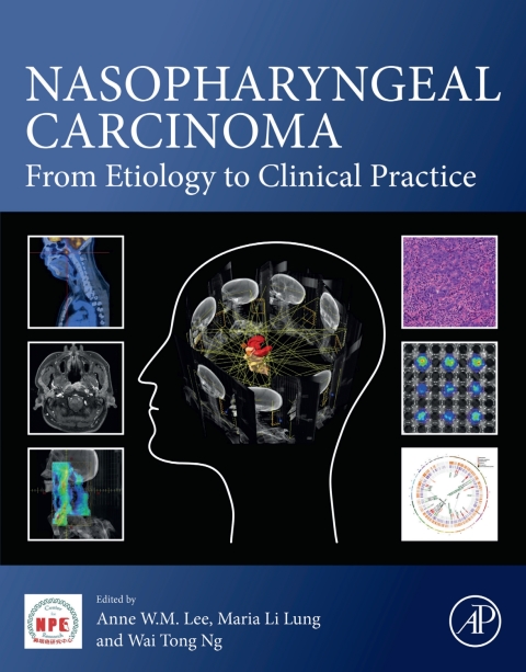 Cover image for book Nasopharyngeal Carcinoma