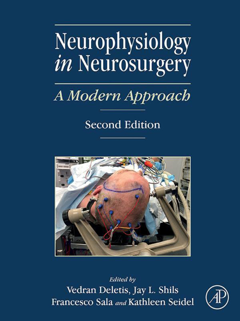 Cover image for book Neurophysiology in Neurosurgery
