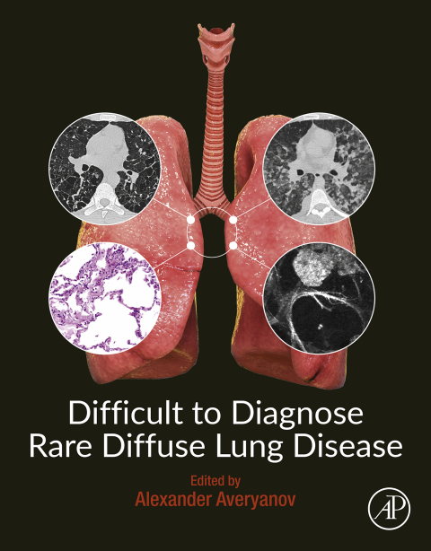 Cover image for book Difficult to Diagnose Rare Diffuse Lung Disease