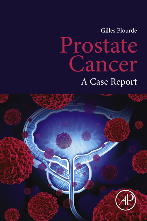 Cover image for book Prostate Cancer