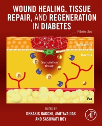 Cover image: Wound Healing, Tissue Repair, and Regeneration in Diabetes 1st edition 9780128164136
