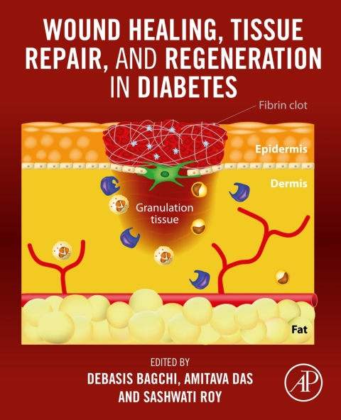 Cover image for book Wound Healing, Tissue Repair, and Regeneration in Diabetes