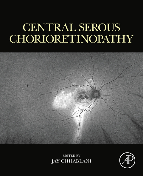 Cover image for book Central Serous Chorioretinopathy
