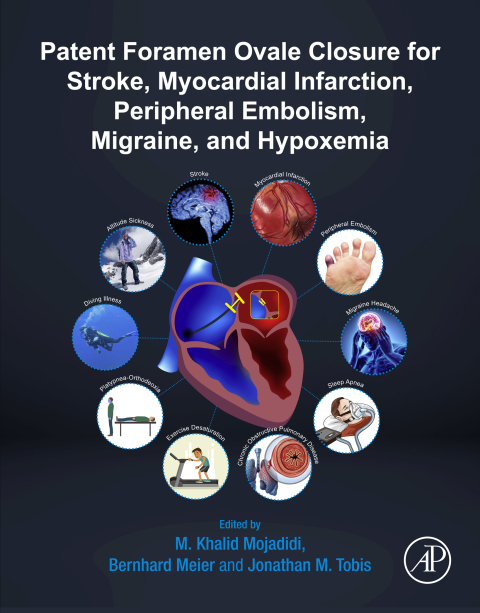 Cover image for book Patent Foramen Ovale Closure for Stroke, Myocardial Infarction, Peripheral Embolism, Migraine, and Hypoxemia