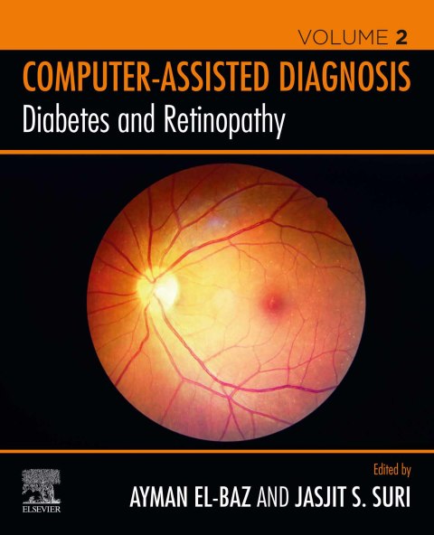 Cover image for book Diabetes and Retinopathy