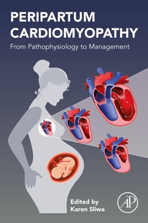 Cover image for book Peripartum Cardiomyopathy
