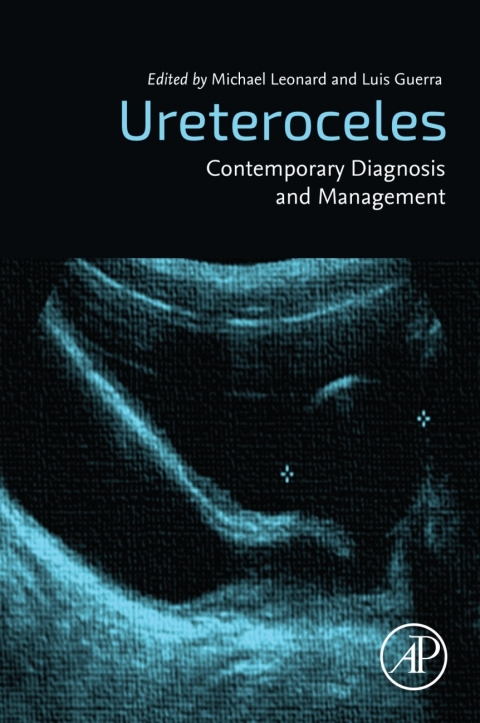 Ureteroceles 
