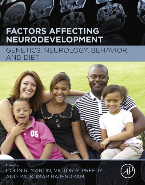 Cover image for book Factors Affecting Neurodevelopment