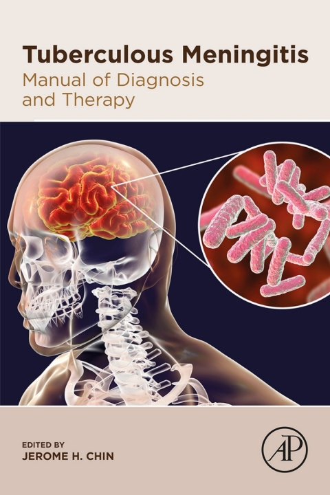 Cover image for book Tuberculous Meningitis