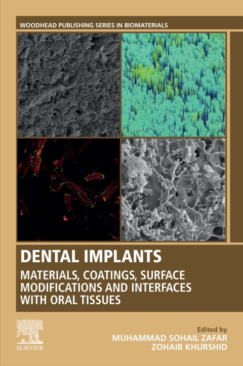Cover image for book Dental Implants
