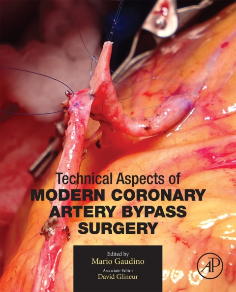 Cover image for book Technical Aspects of Modern Coronary Artery Bypass Surgery