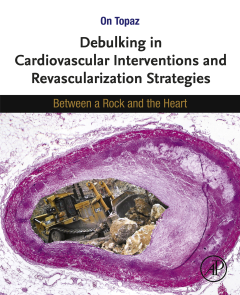 Cover image for book Debulking in Cardiovascular Interventions and Revascularization Strategies