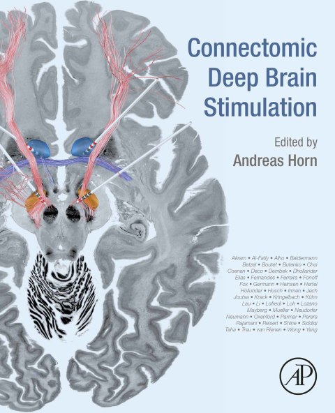Cover image for book Connectomic Deep Brain Stimulation