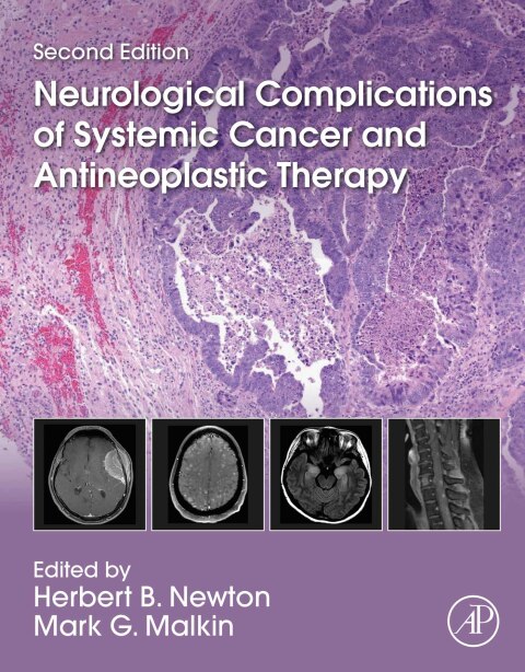 Cover image for book Neurological Complications of Systemic Cancer and Antineoplastic Therapy