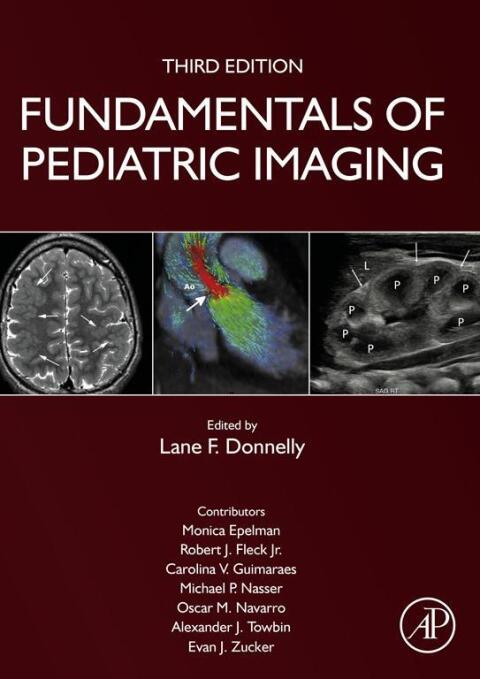Cover image for book Fundamentals of Pediatric Imaging