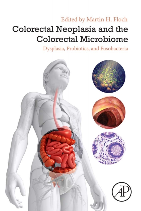 Cover image for book Colorectal Neoplasia and the Colorectal Microbiome