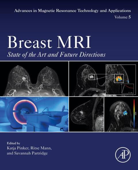 Cover image for book Breast MRI