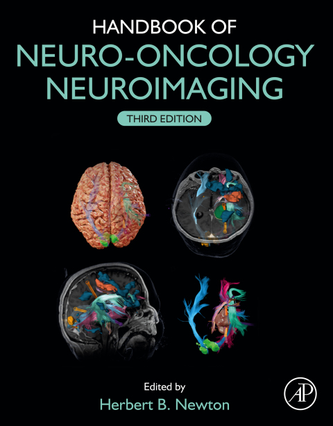 Cover image for book Handbook of Neuro-Oncology Neuroimaging