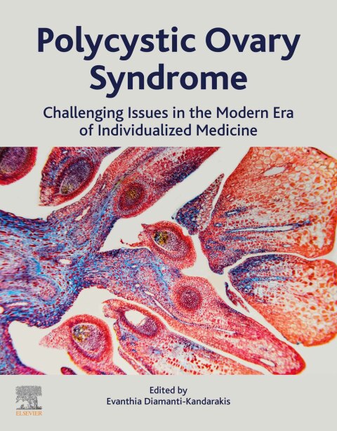 Cover image for book Polycystic Ovary Syndrome