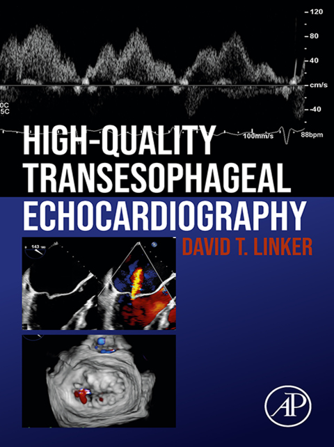 Cover image for book High-Quality Transesophageal Echocardiography