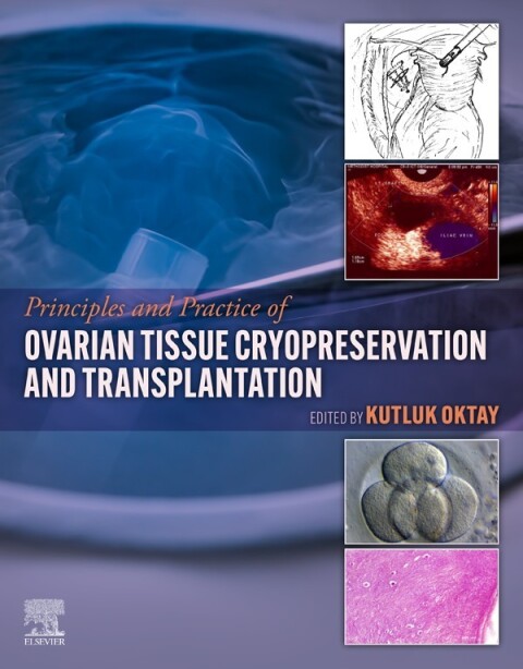 Cover image for book Principles and Practice of Ovarian Tissue Cryopreservation and Transplantation