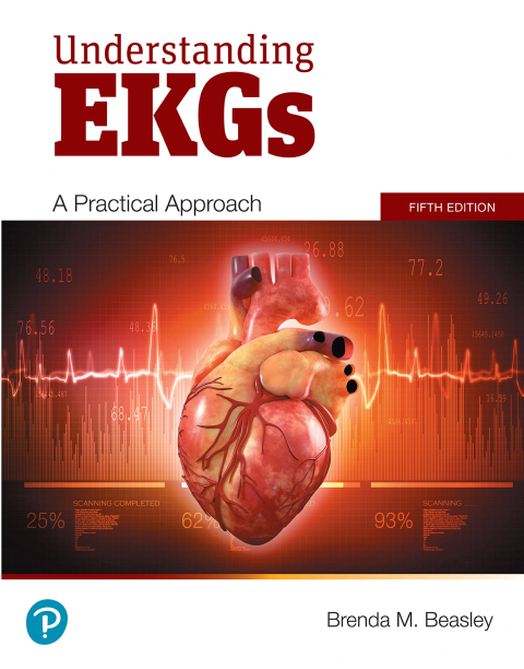 Cover image for book Understanding EKGs: A Practical Approach