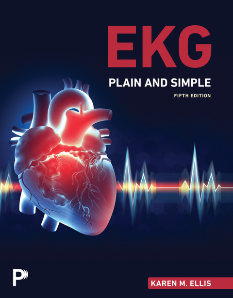 Cover image for book EKG Plain and Simple (Pearson+)