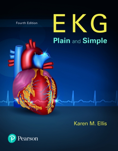 Cover image for book EKG Plain and Simple (Pearson+)