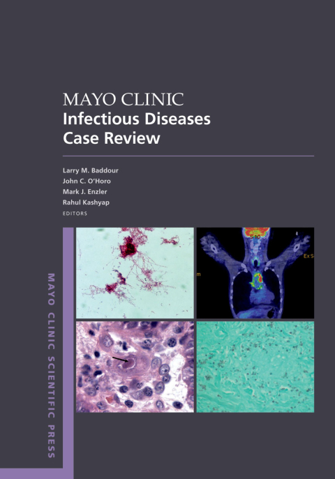 Cover image for book Mayo Clinic Infectious Diseases Case Review