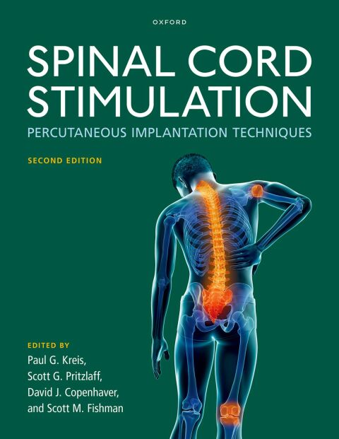 Cover image for book Spinal Cord Stimulation